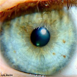 Stem cell treatment can restore natural vision